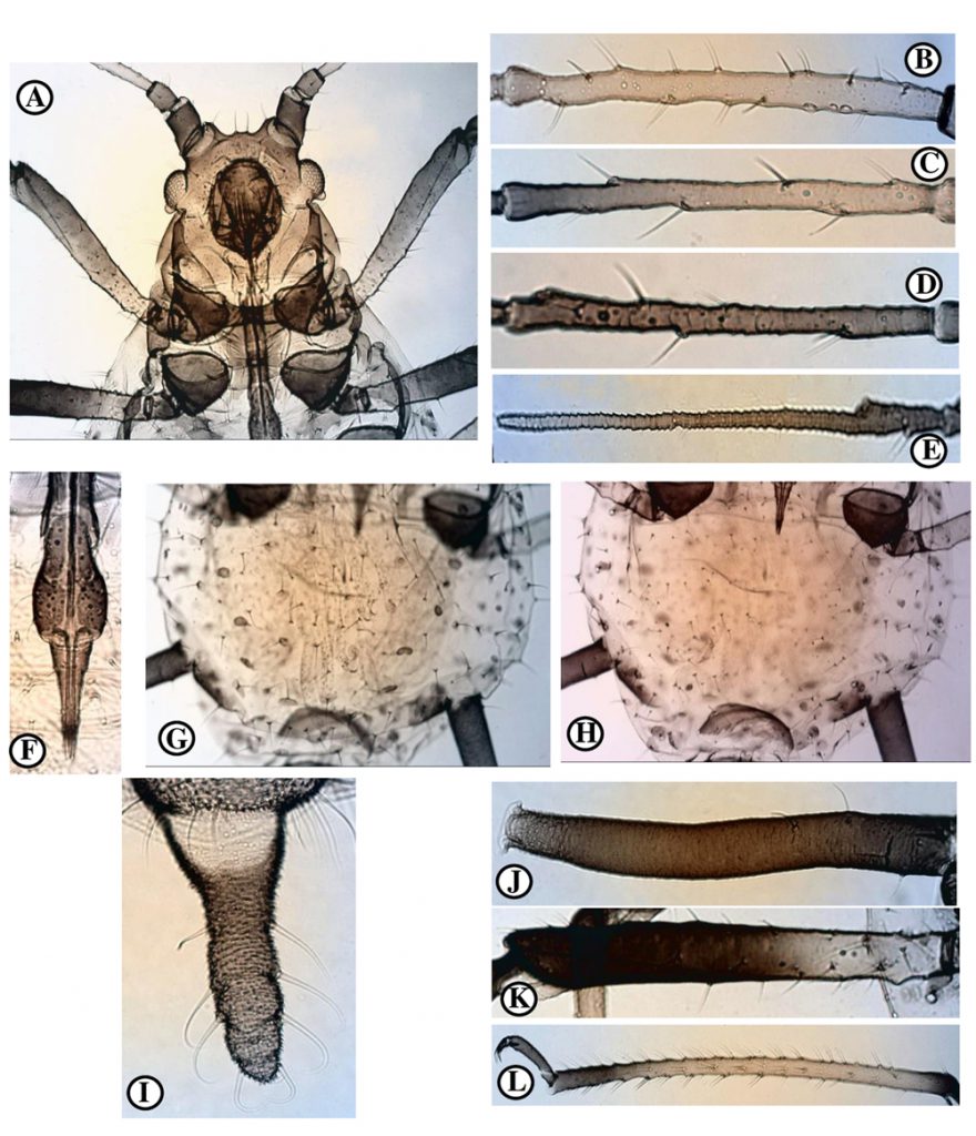Obtusicauda iranica sp. n., apterous viviparous female. A- Head and antennal tubercles, B. ANTIII with secondary rhinaria, C- ANTIV, D- ANTV, E- ANTVI, F- URS, G- dorsal surface of abdo-men, H- ventral surface of abdomen, I- cauda, J- SIPH, K- hind femur, L- hind tibia and tarsus.